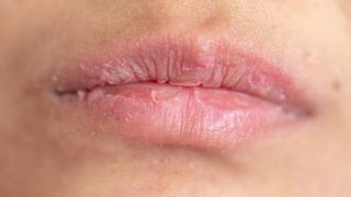 Conoce los mejores exfoliantes naturales para tratar labios agrietados