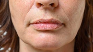 Cómo prevenir y eliminar el código de barras en los labios