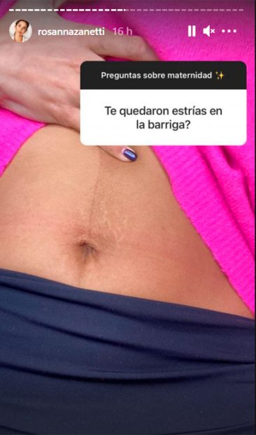 Rosanna Zanetti muestra las estrías secuela del embarazo / Instagram