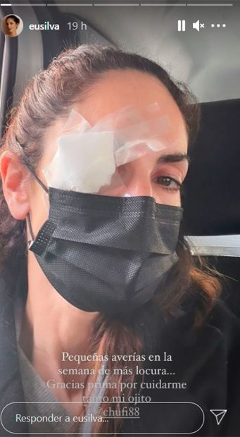 Eugenia Silva ha aparecido con un ojo vendado / Instagram