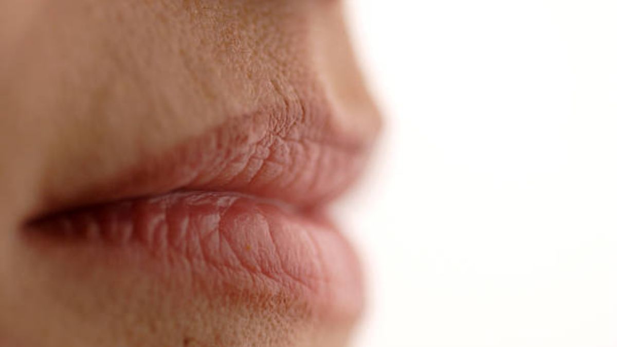 moderadamente mordaz artículo Elimina las arrugas de los labios con remedios naturales