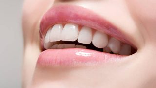 Descubre los mejores remedios naturales para tener unos dientes blancos