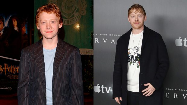 Rupert Grint antes y después./Gtres