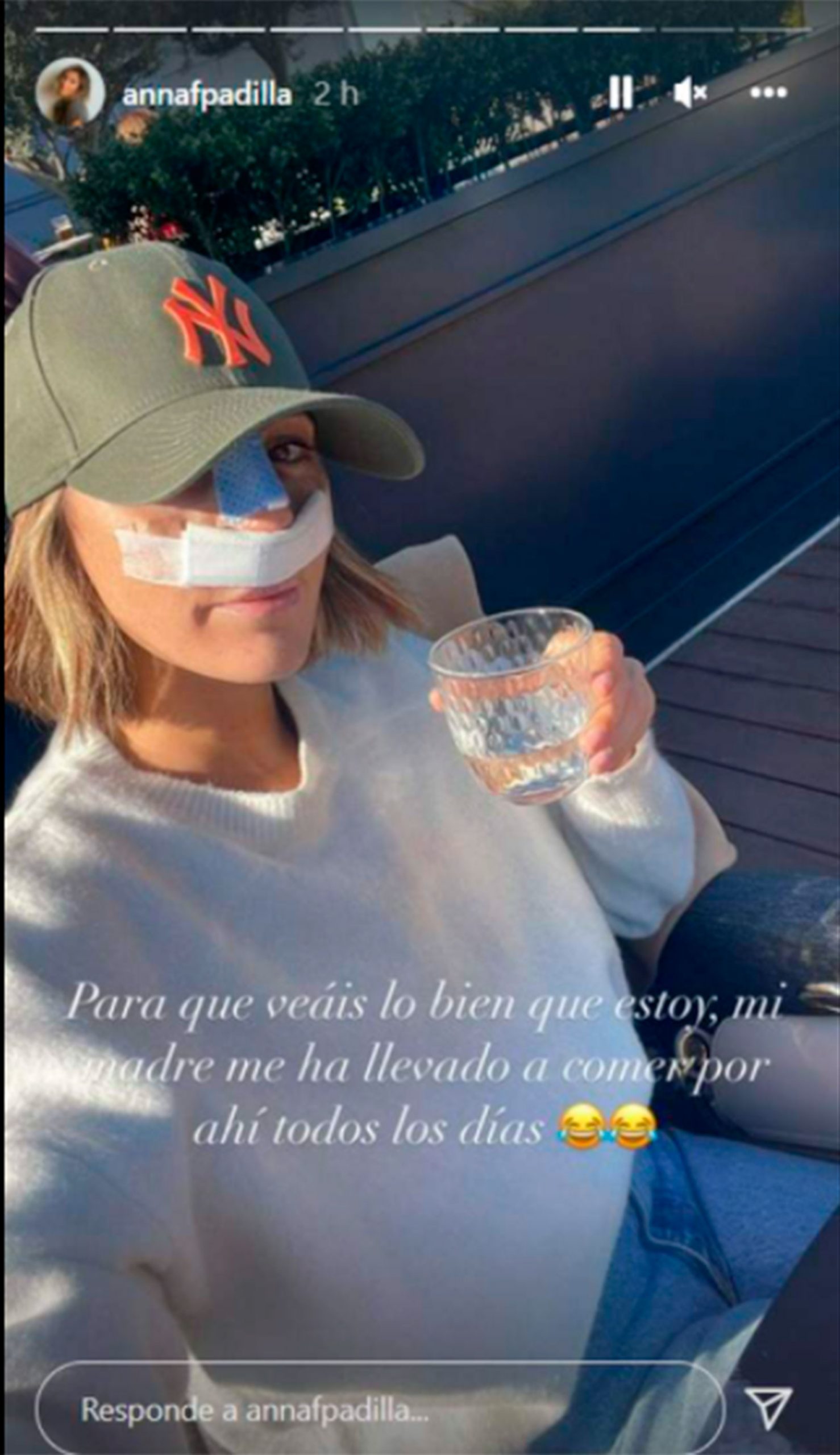 Anna Ferrer se ha sometido a una rinoplastia. / Instagram