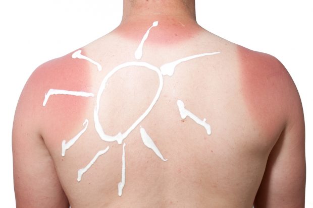 Elige el protector solar ideal según las necesidades de tu piel