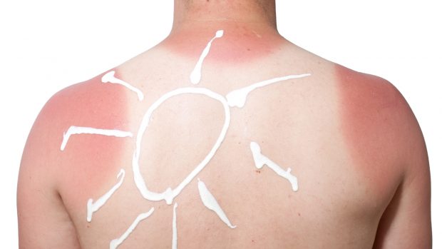 Hay que proteger nuestra piel de la exposición solar / Gtres