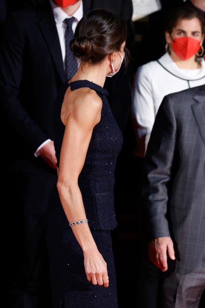 La Reina Letizia mostrando uno de sus brazos / Gtres