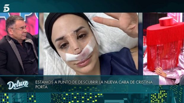 Famosas cirugía estética, famosas posoperatorios, famosas operaciones cara