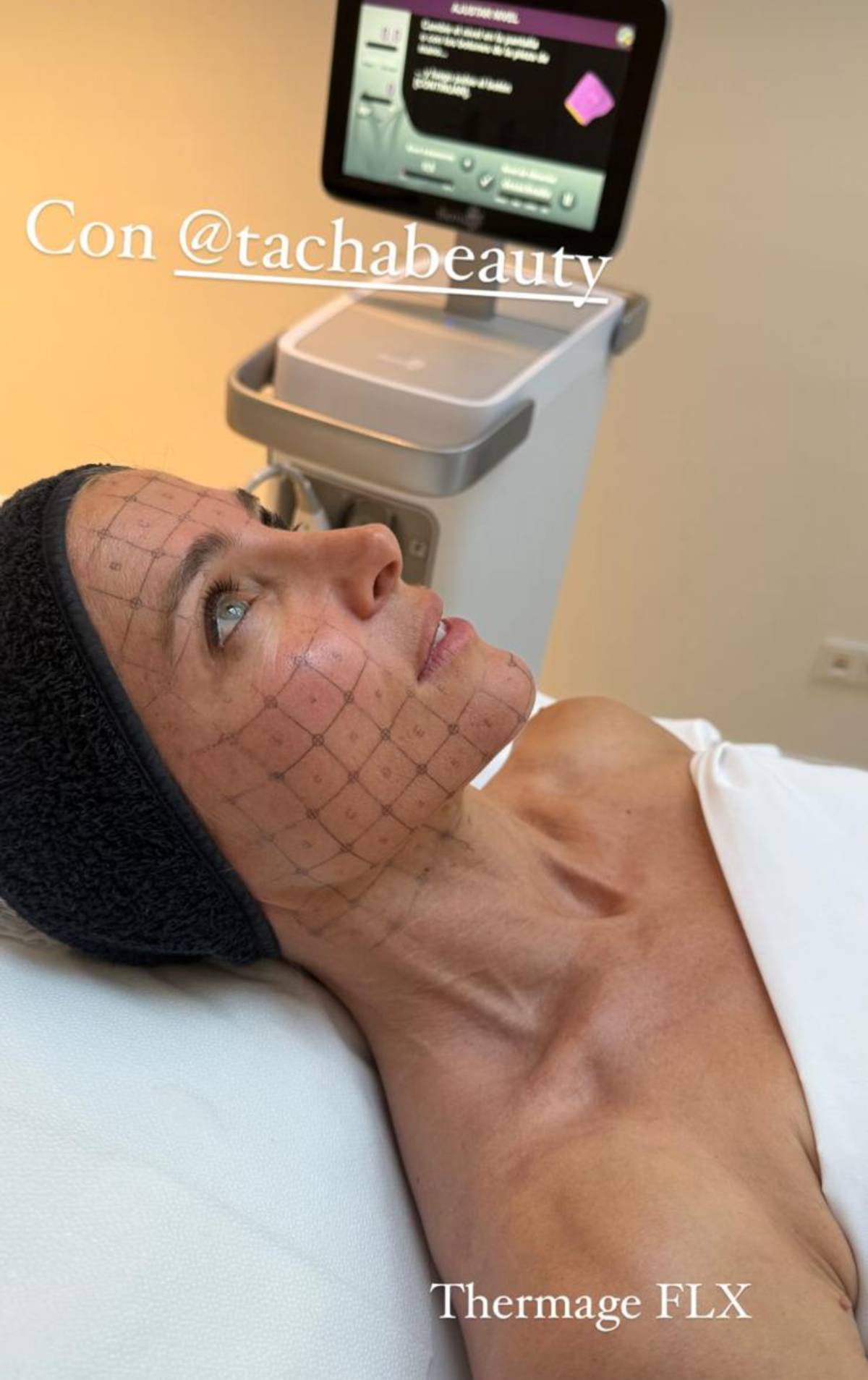 Elsa Pataky en pleno procedimiento de Thermage FLX, recostada sobre una camilla en la clínica estética TACHA. (Redes Sociales)
