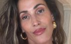 Una experta en medicina estética aplaude el cambio de Malú y desvela su secreto: 