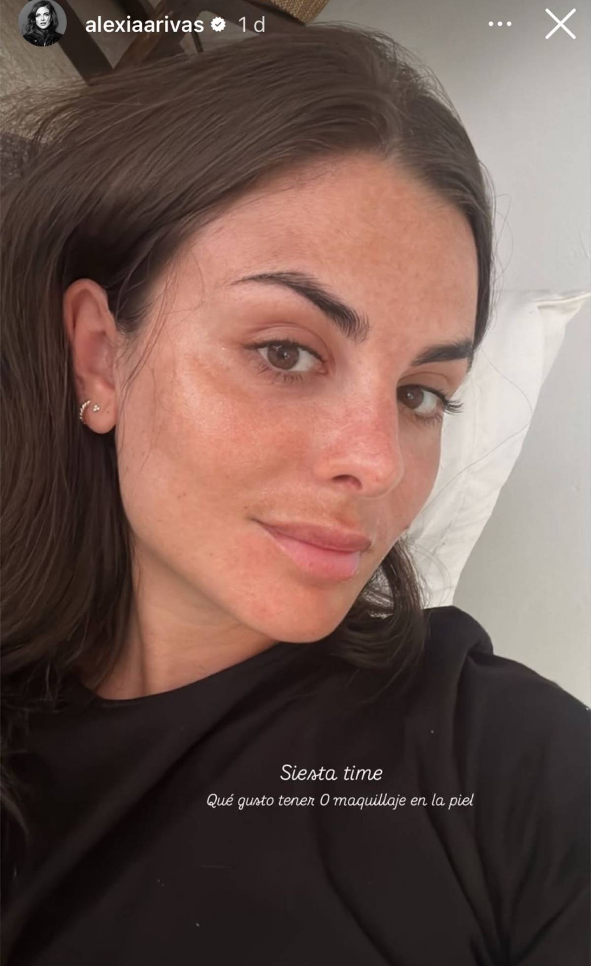 Selfie de Alexia Rivas sin maquillaje mostrando su piel al natural. (Redes Sociales)