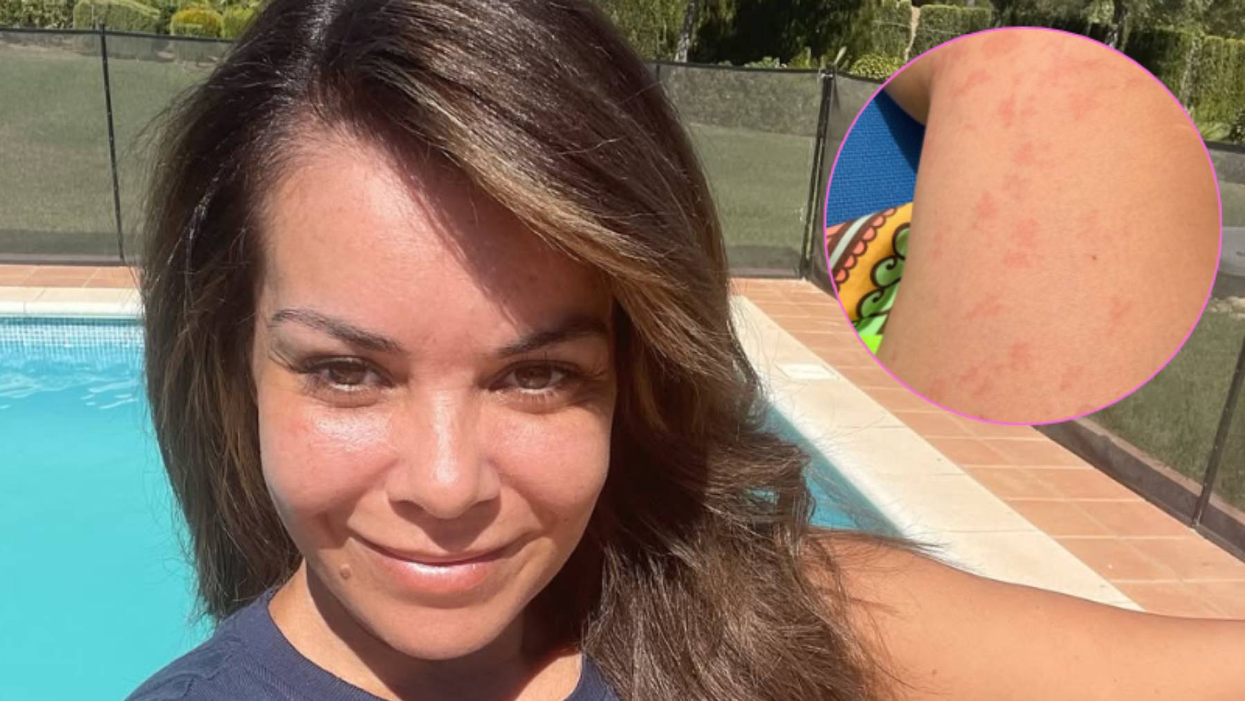 El último revés de salud de María José Campanario en plenas vacaciones: "Nueva alergia desbloqueada"