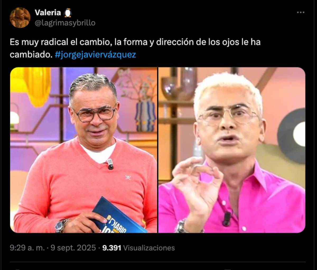 Un antes y un después del rostro del presentador.