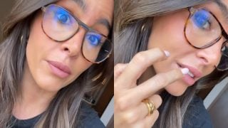 Rocío Osorno enseña su nuevo retoque estético. (FOTOS: REDES SOCIALES)