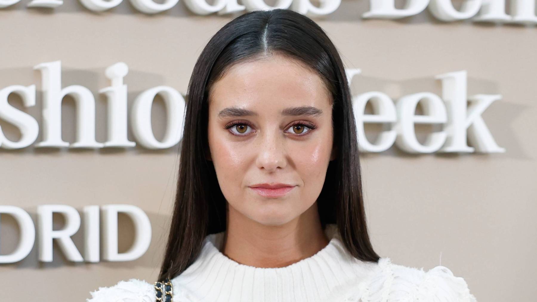 De los labios al pecho: los 9 retoques estéticos de Victoria Federica, según los especialistas