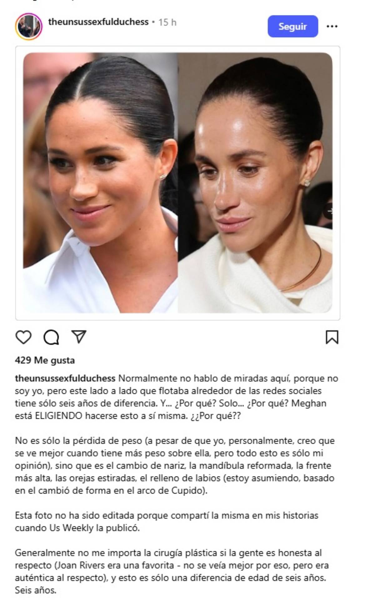 La imagen que circula en redes sociales —publicada por la cuenta TheUnSussexfuIDuchess— muestra un collage comparativo.