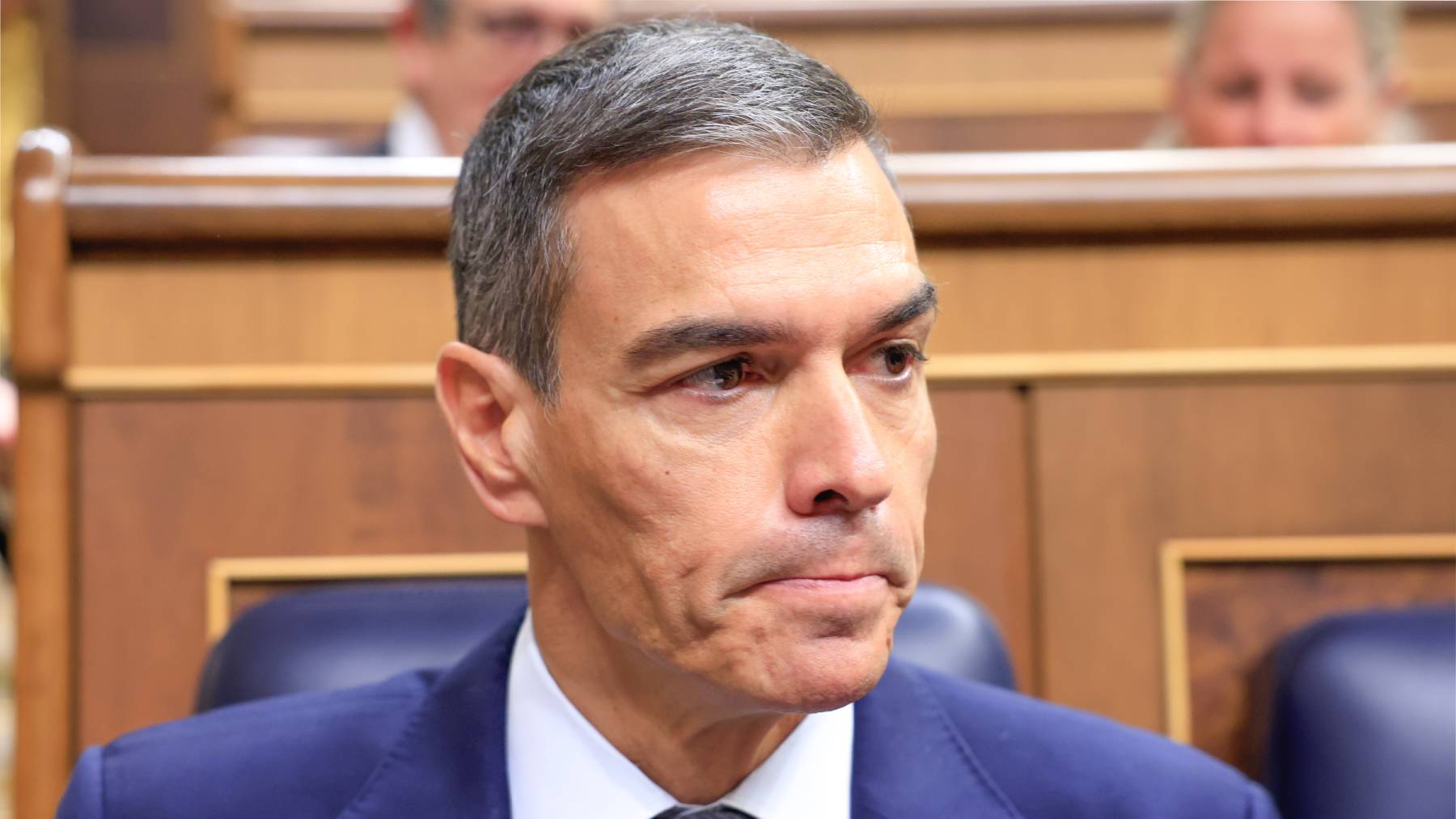 ¿Qué le haría un médico estético a Pedro Sánchez? El cambio empieza en el pómulo