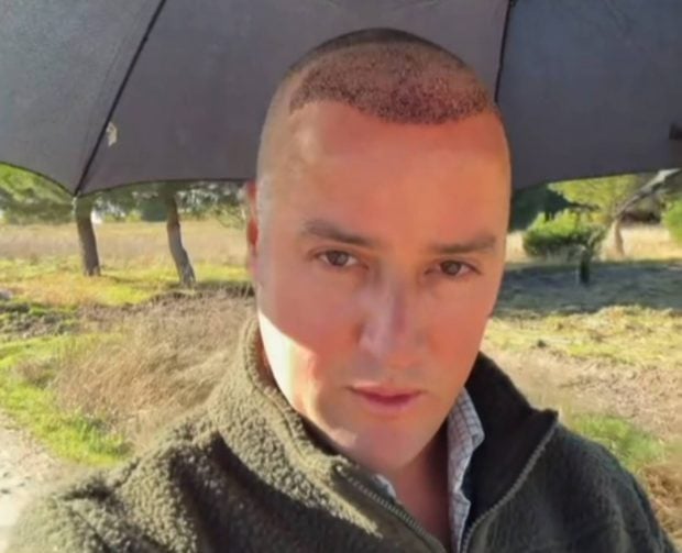 Álvaro López Huerta paseando con sombrilla tras el injerto. (Foto: Instagram)