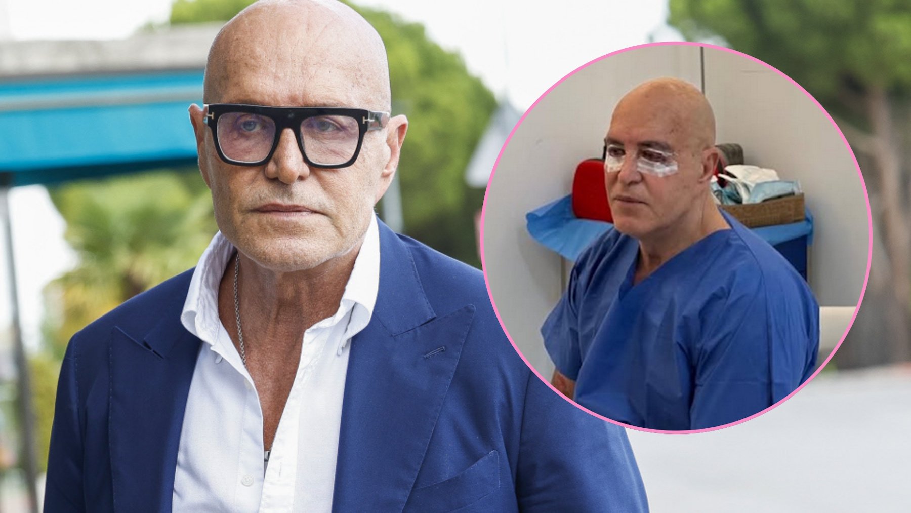 La impactante foto de Kiko Matamoros después de operarse los párpados: Le hacía falta