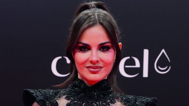 Alexia Rivas y otras famosas con problemas de alopecia que han querido contarlo