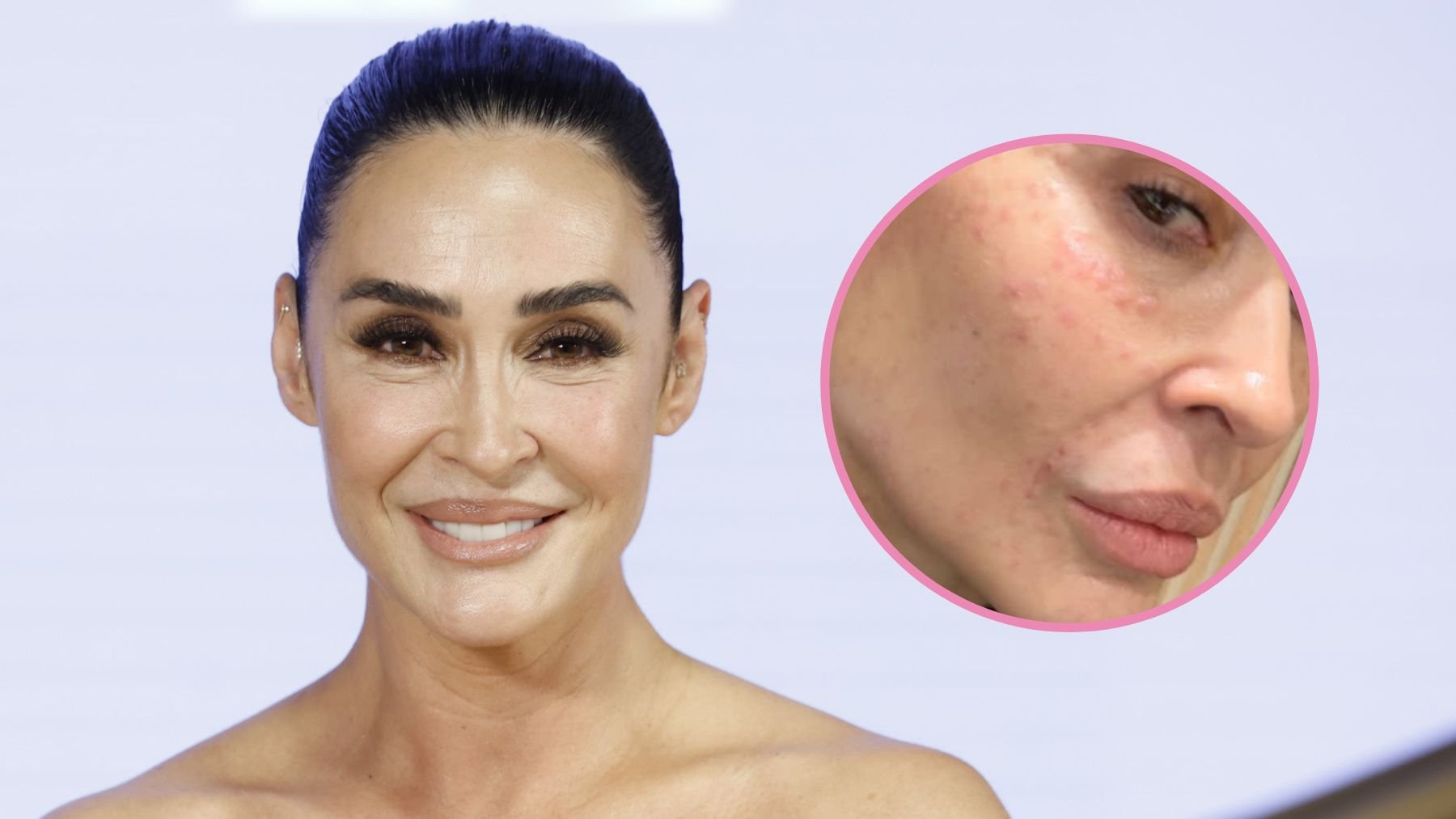 El curioso tratamiento de belleza por el que ha apostado Vicky Martín Berrocal: Es semen de salmón