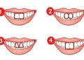 Teeth, personality, test