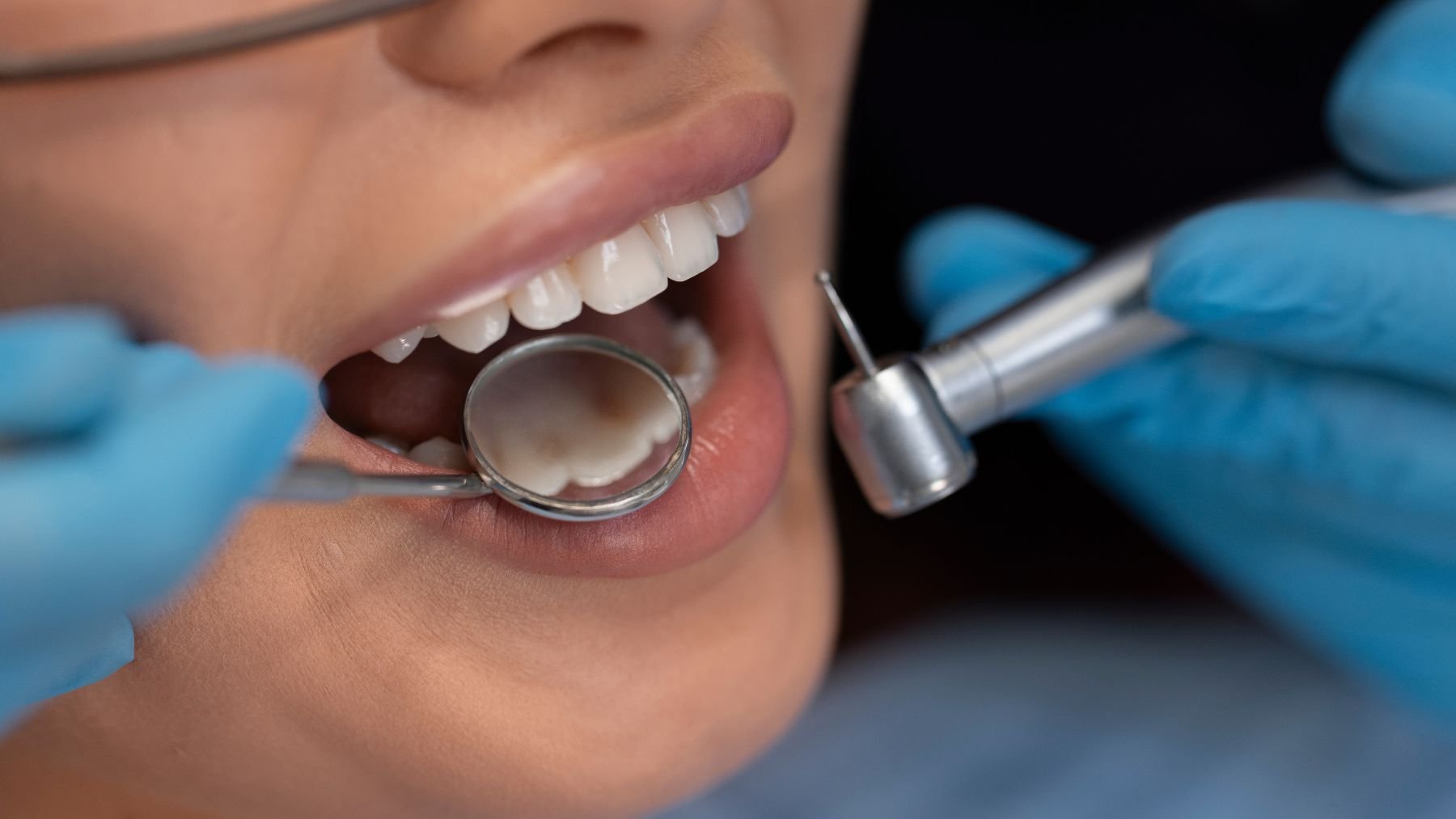dentist, teeth