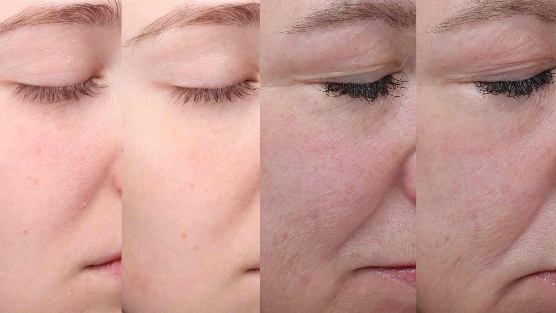 Before-and-after images showing visible skin improvement after 12 weeks of a 10-peptide face and neck serum