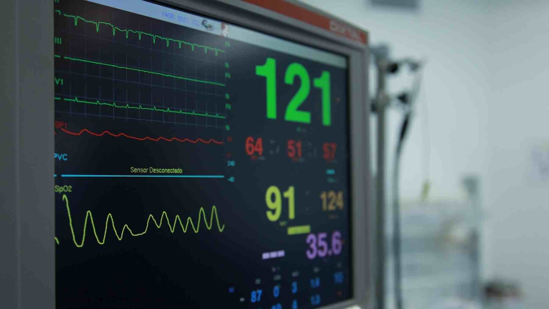 Heart monitor showing cardiac readings for an article about stair climbing and heart health