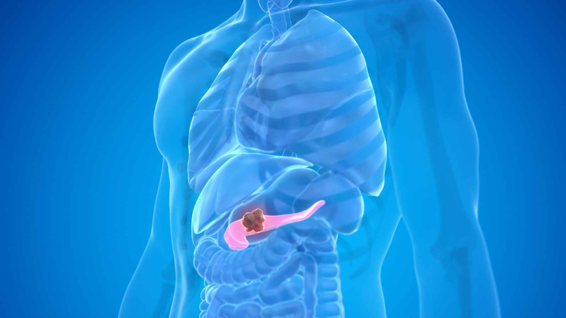 A medical AI software interface highlighting subtle tissue changes in a CT scan of the pancreas for early cancer detection.