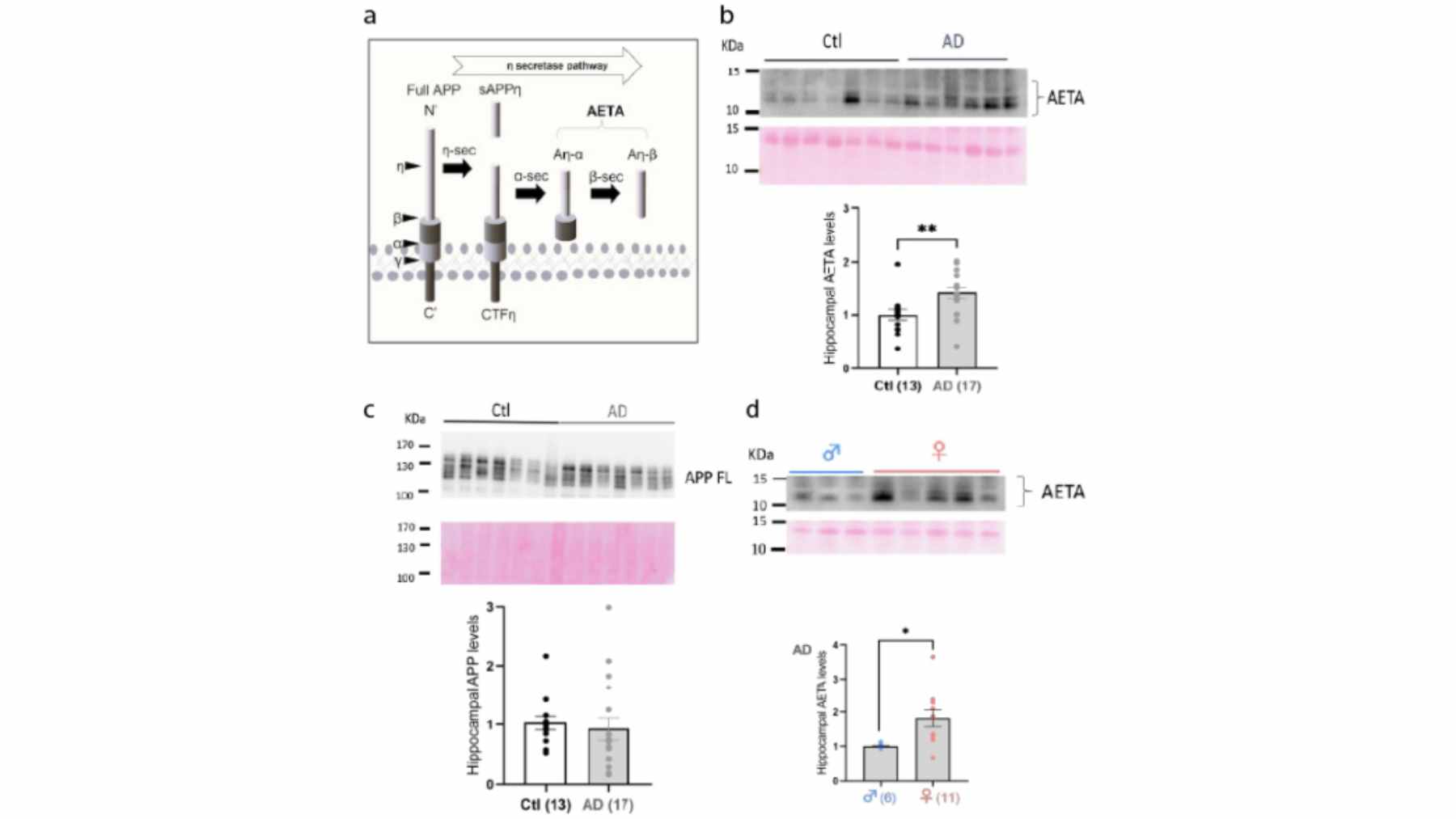 A scientific visualization of neural synapses weakening, illustrating the early-stage brain changes linked to AETA peptide accumulation in Alzheimer's.