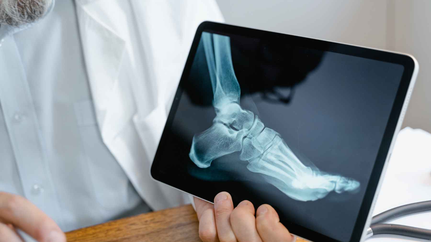 Older adult holding calcium and vitamin D supplements as new research questions their role in fracture prevention.
