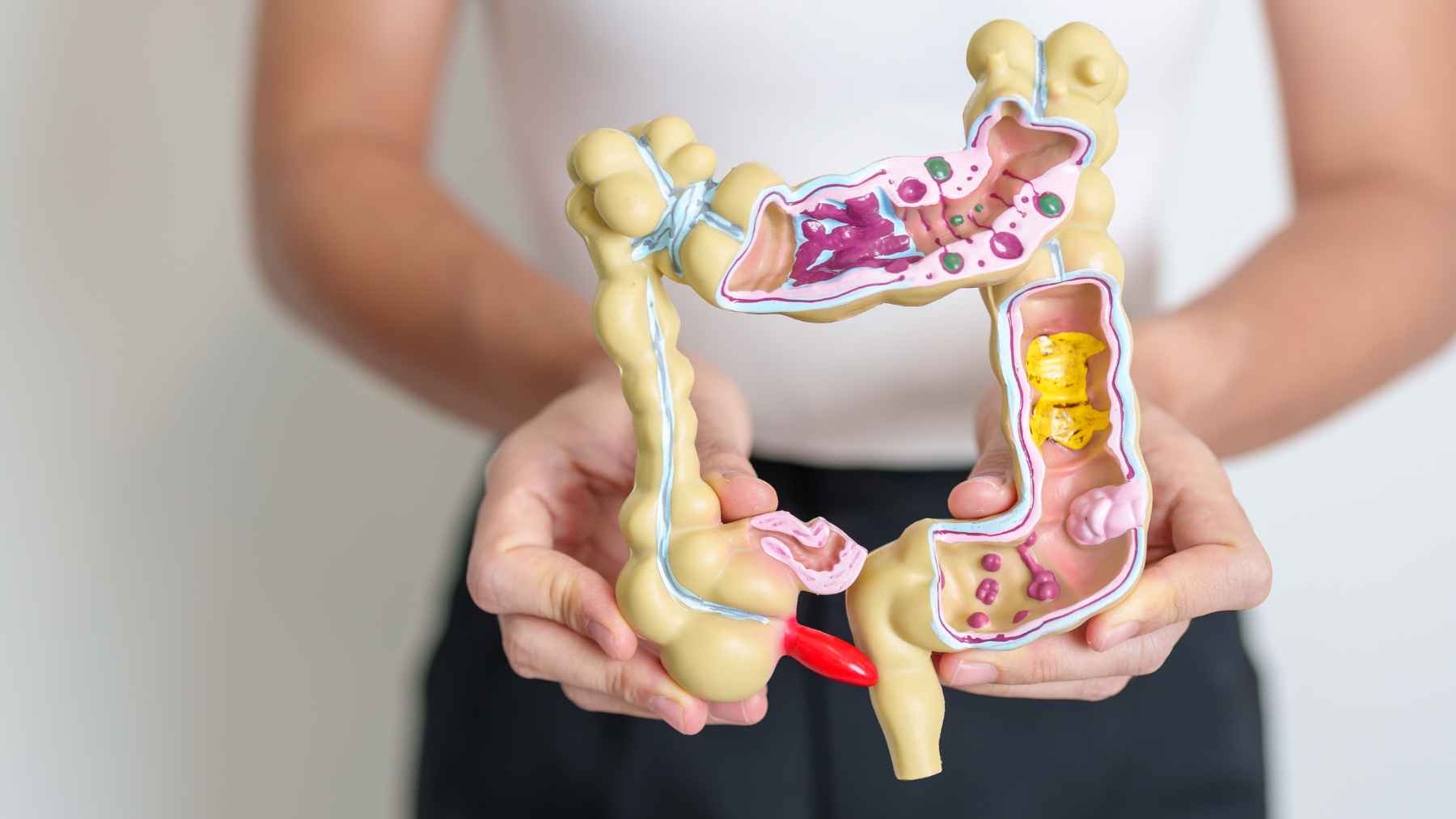 A Business Insider story links constipation to early colon cancer in a young person, and the warning is the symptom people normalize until it’s too late 1 Medical model of the human colon illustrating colorectal cancer, bowel obstruction, and digestive health conditions linked to persistent constipation.