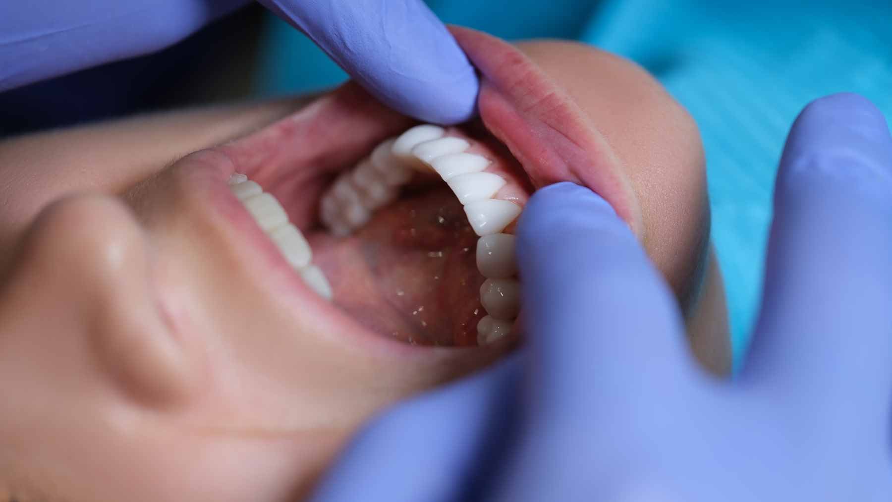 A dentist examining a patient's tooth with a probe and X-ray imaging visible on a monitor in the background.