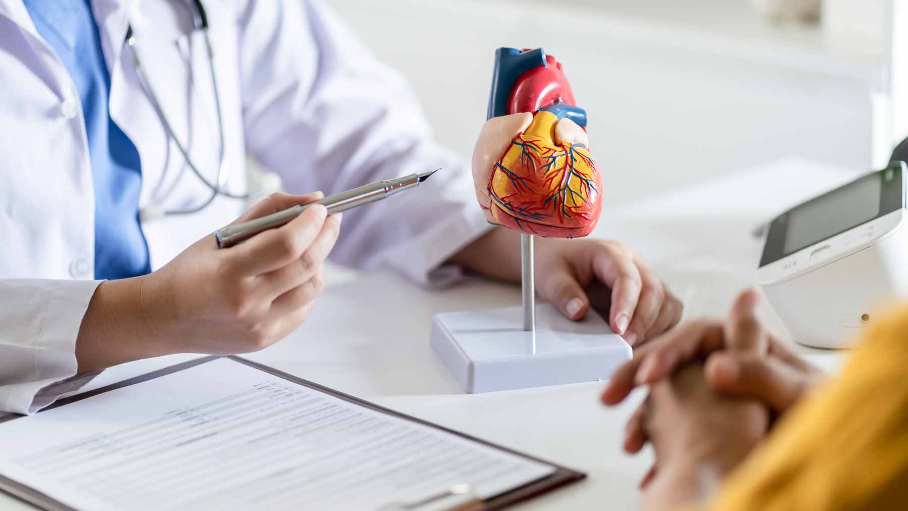 A medical illustration showing the accumulation of LDL cholesterol plaque within an artery wall over time.