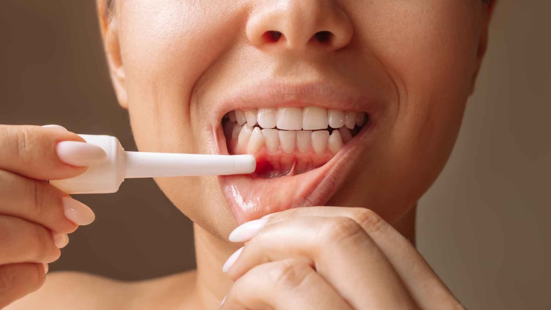 Dental researcher studying bacterial communication in oral plaque to develop personalized treatments for gum inflammation