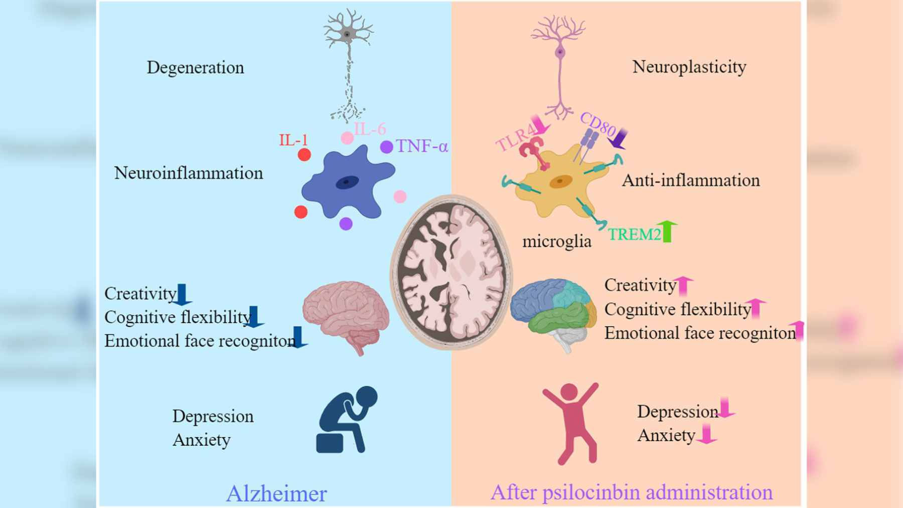A medical researcher reviewing brain network connectivity data during a study on the potential effects of psilocybin on neurodegenerative conditions.