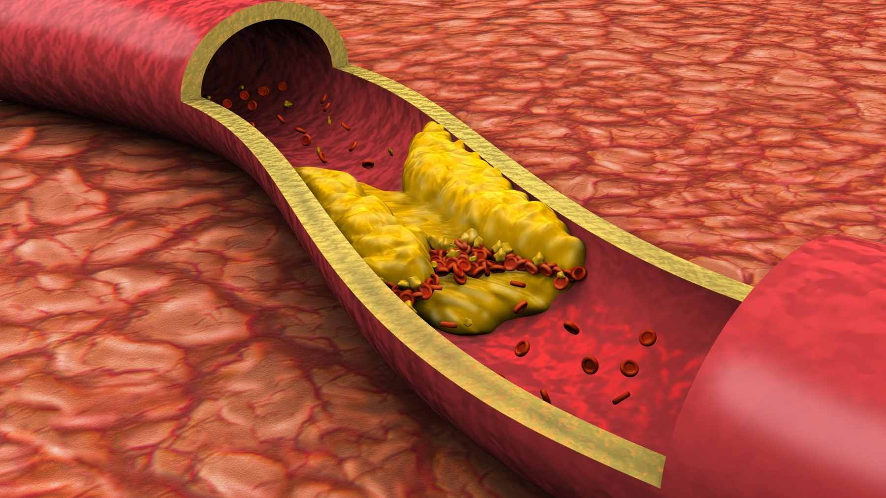 A physician reviewing cholesterol lab results and discussing long-term cardiovascular risk with a patient.