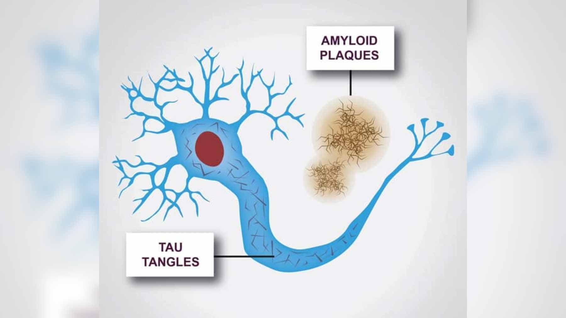Scientists found how one toxic protein hijacks your healthy brain cells and spreads Alzheimer's from neuron to neuron, but there may be a treatment coming 1 A scientific visualization showing toxic Tau proteins hitching a ride inside an Arc-mediated extracellular vesicle between two neurons.