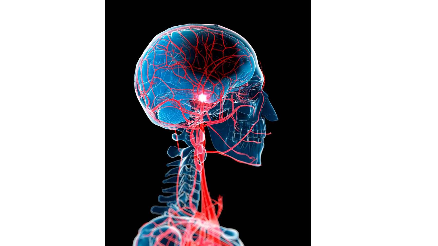 Science says the same thing happens in your body before most heart attacks and strokes, and this is the sign to watch for 1 Medical illustration showing the brain and its blood vessels, highlighting how reduced blood flow can lead to a stroke.