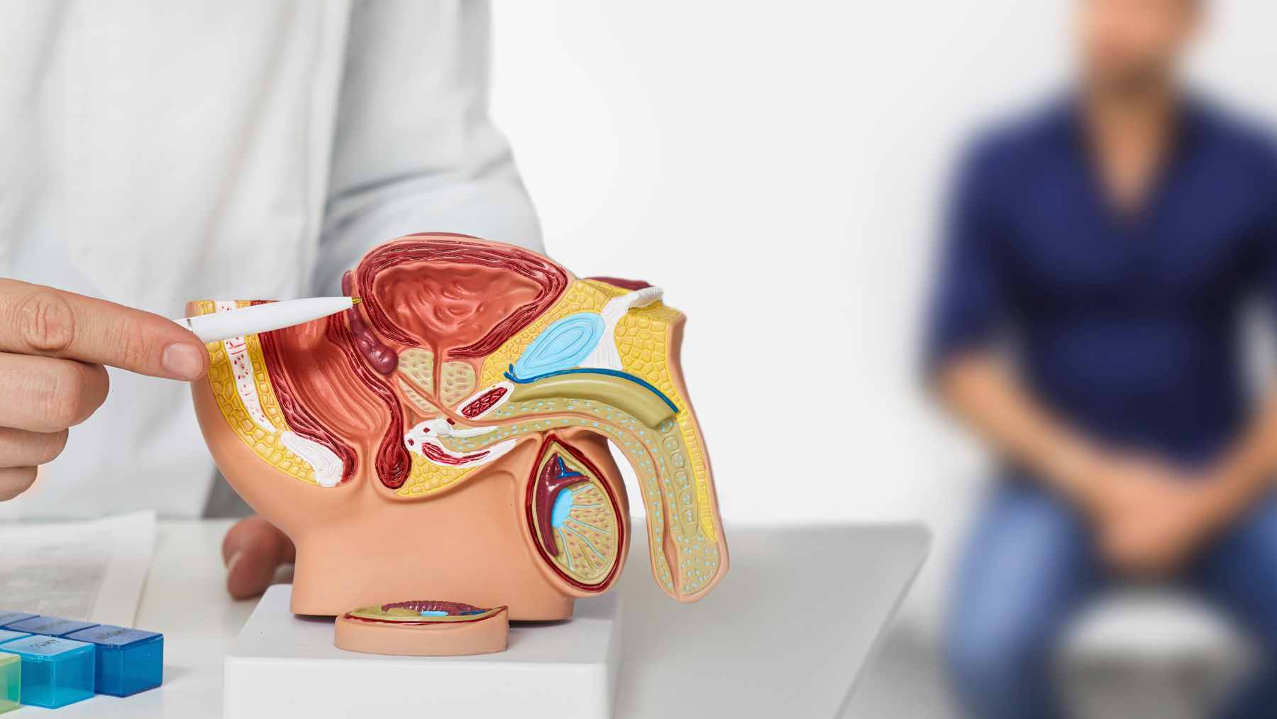 A conceptual medical visualization of precision radiation therapy used to target prostate cancer recurrence with high accuracy.