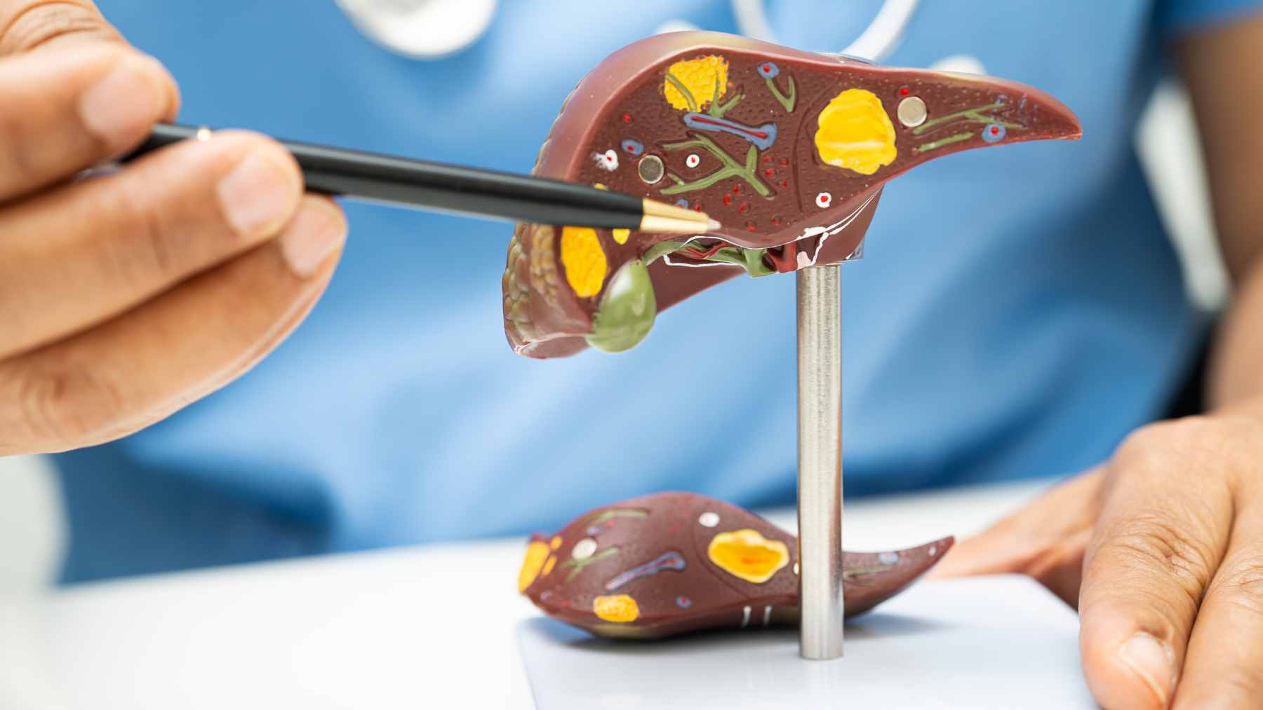 Your fatty liver can stay silent for years before turning dangerous, but experts say one everyday habit could help it regenerate itself 1 A plate filled with Mediterranean-style heart-healthy foods like salmon, leafy greens, and whole grains, symbolizing a healthy diet for liver support.