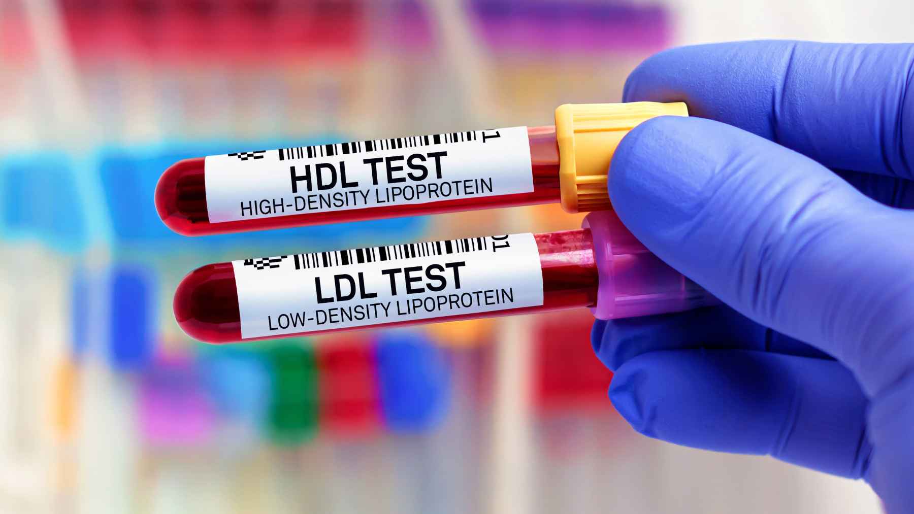 One cheap grocery-store fiber could quietly lower your LDL cholesterol, but the reason it works reaches far beyond your gut 1 Close-up of blood samples labeled HDL and LDL during a laboratory cholesterol test.