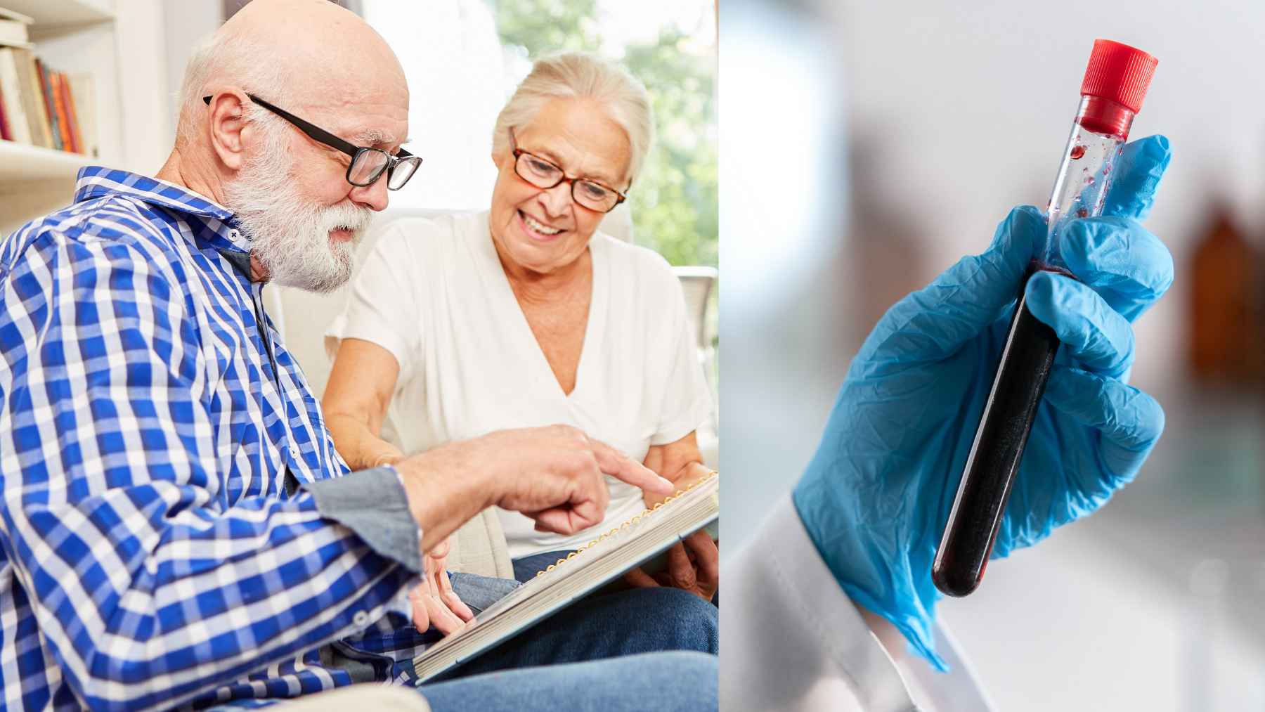 Medical illustration or brain imaging representing microscopic blood clots linked to Alzheimer's disease progression and reduced brain blood flow.