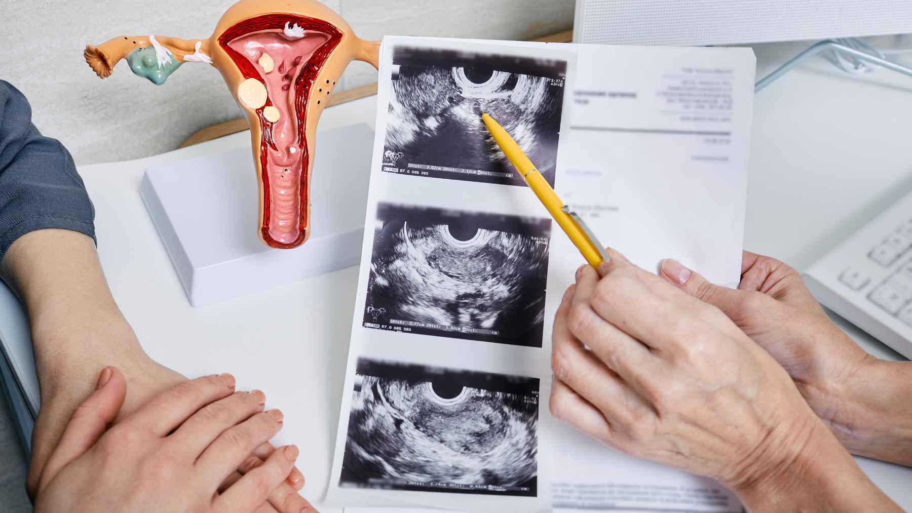 Your ovaries may not fall silent after menopause after all: scientists just uncovered a surprising new role they quietly take on 1 Doctor reviews ovarian ultrasound images while explaining new research on postmenopausal ovaries and their possible immune-like activity.