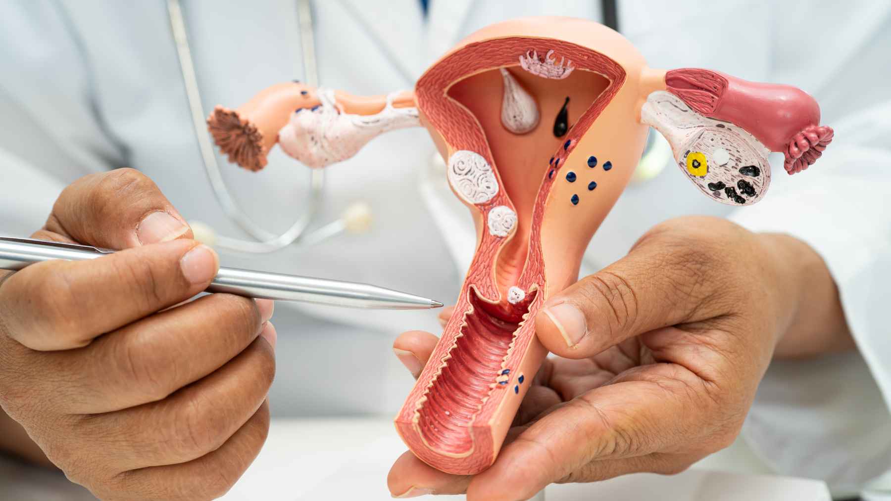 Medical illustration representing menopause and postmenopausal ovarian activity linked to a newly discovered immune-like function.