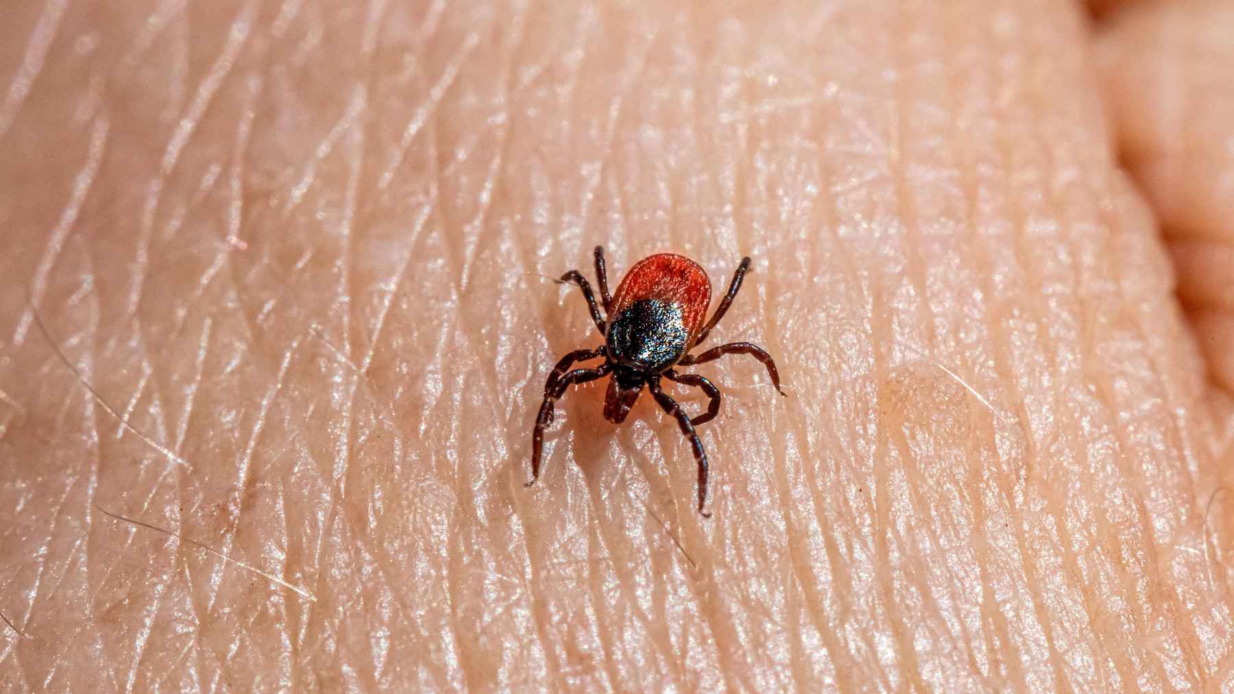 It's not just a bad meal: a single tick bite could change what you eat for the rest of your life 2 A lone star tick on human skin, representing the tick bites that transmit alpha-gal syndrome and trigger red meat allergies.