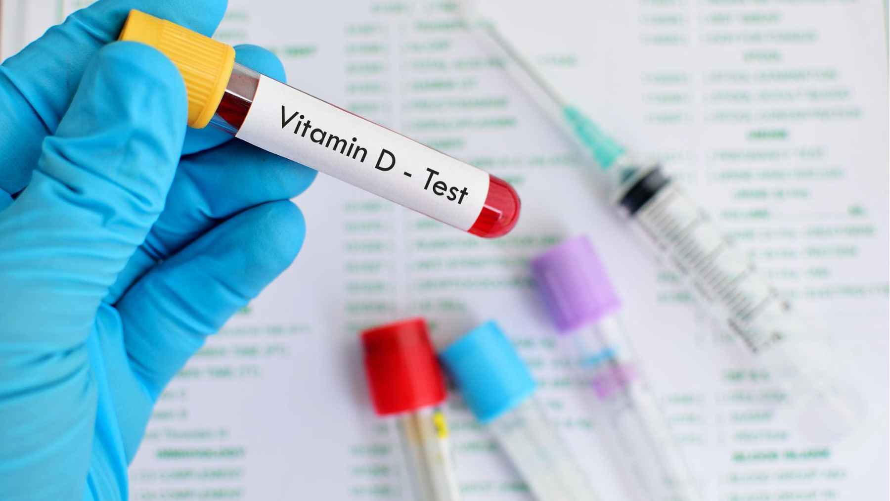 Blood sample labeled "Vitamin D Test" used to diagnose vitamin D deficiency through a laboratory blood test.