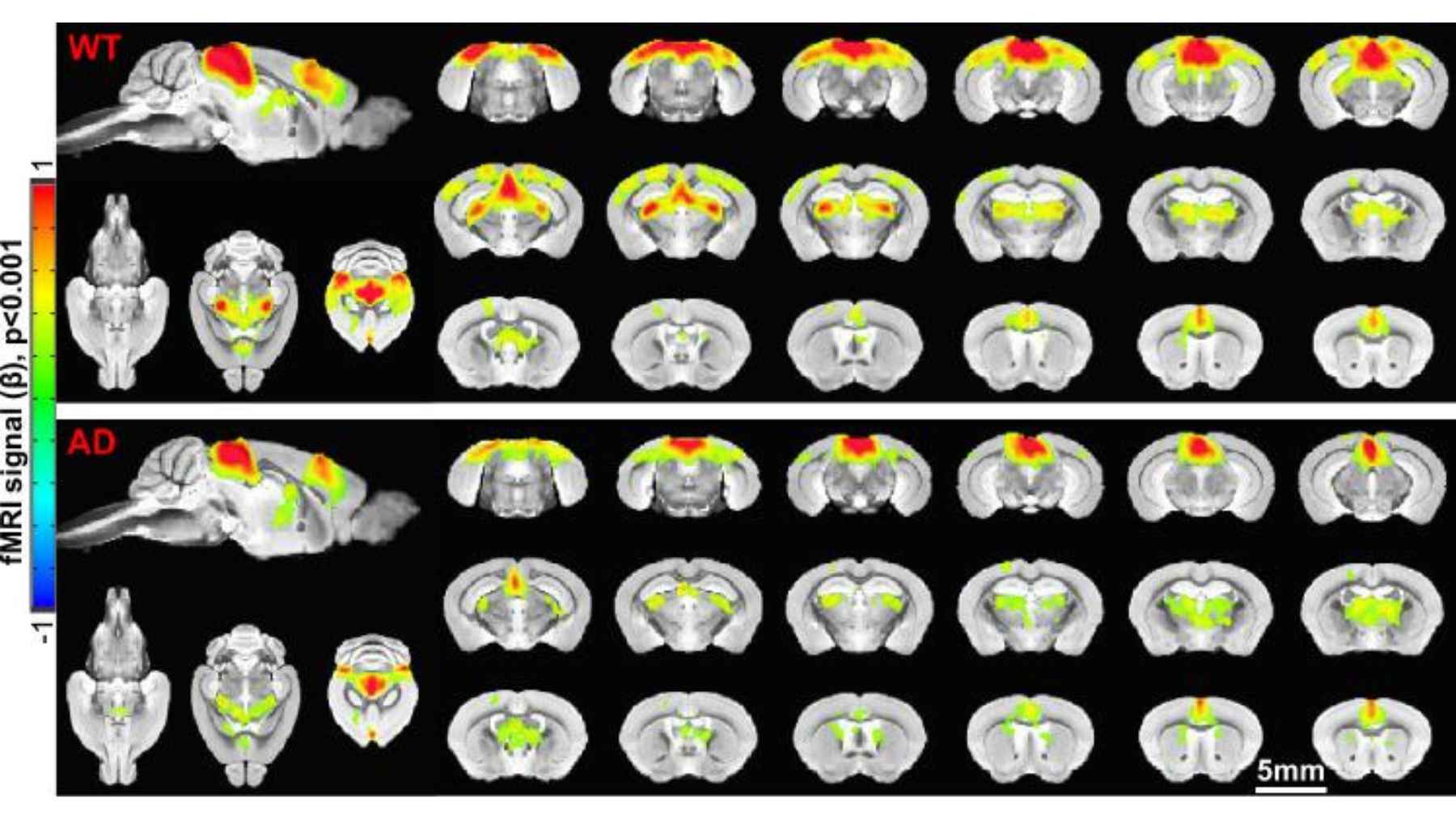Brain scans comparing healthy and Alzheimer’s disease mice, showing differences in brain activity highlighted in red and yellow
