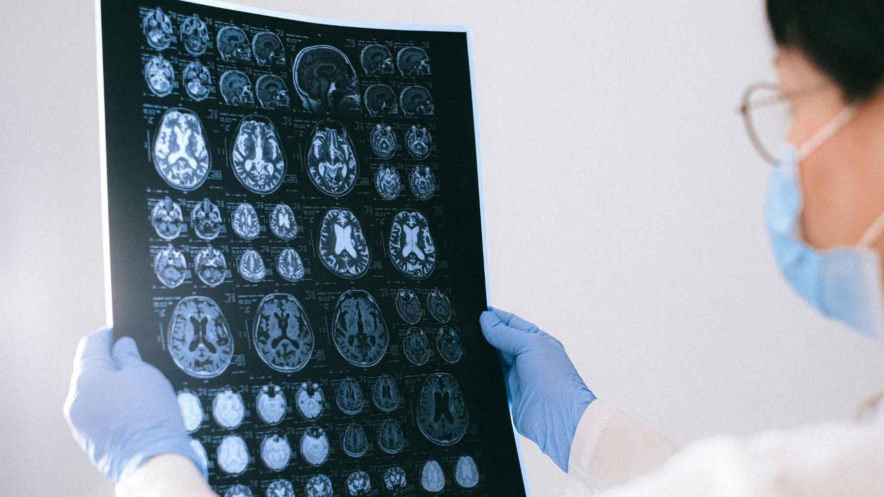 Doctor examining a brain scan, illustrating research into Alzheimer’s disease, brain activity, and sleep disruption